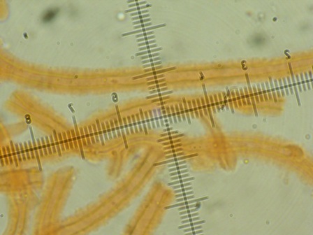 Dacrymyces variisporus?